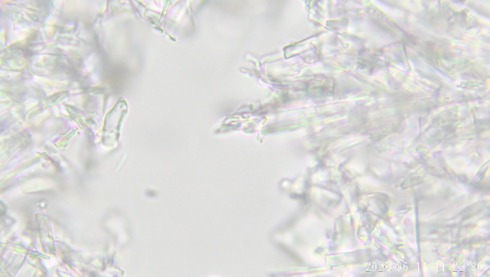 Figure 2 · Optical micrograph of the 11-wash matrix at 1000×, showing plate-like and elongated structures.