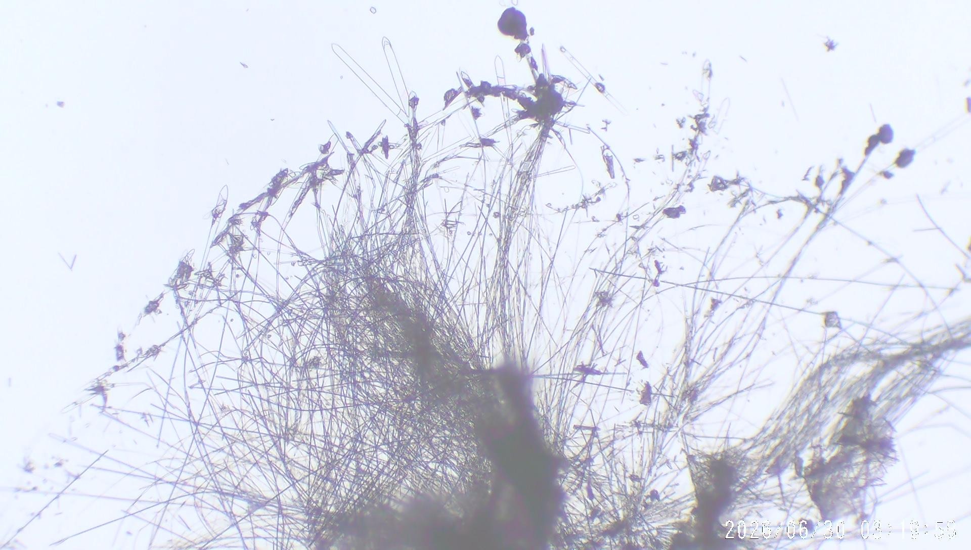 Figure 3 · Optical micrograph of a filtrate fraction, showing filament-like structures and ribbon-like fragments.